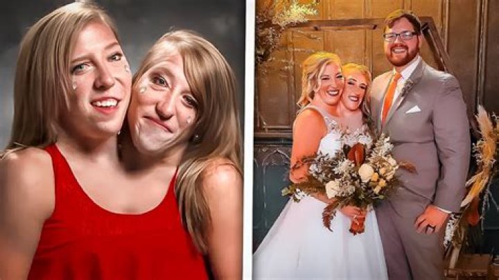 Are Abby And Brittany Hensel Married Relationship Timeline