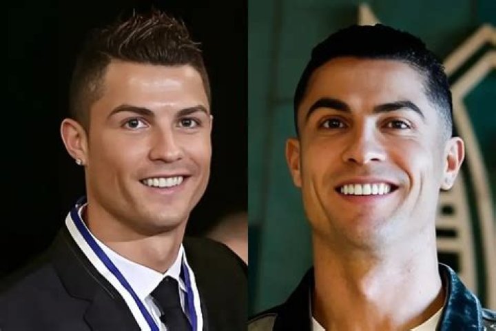 Cristiano Ronaldo Teeth Evolution Over The Years