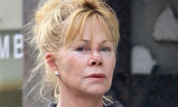 Why Did Melanie Griffith Change Her Face?